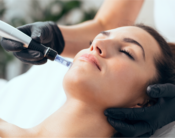 Microneedling