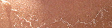 Skin Peeling Systems by DermaFix