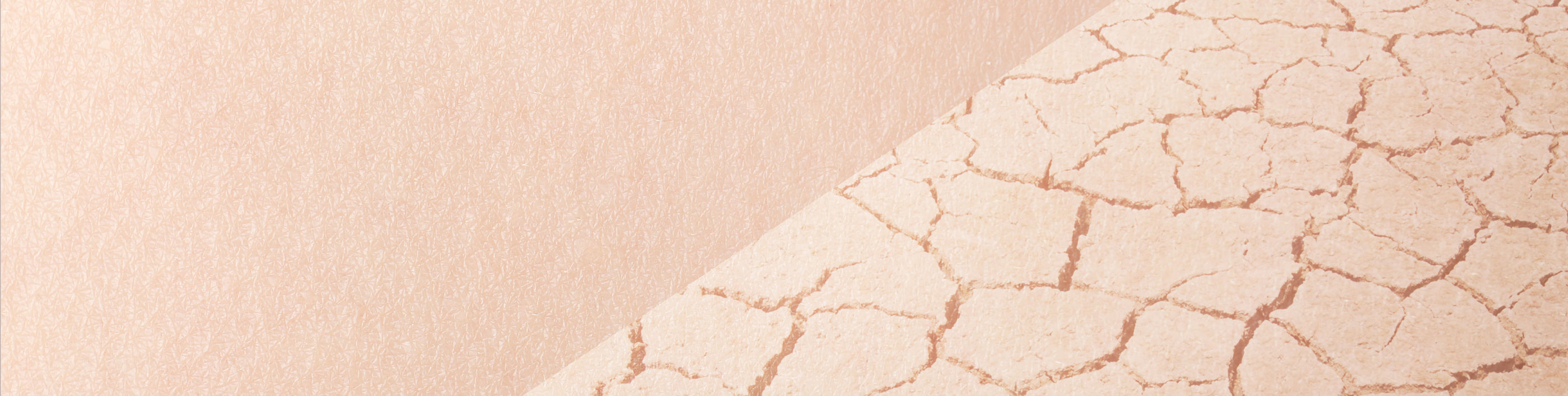 Dry Skin