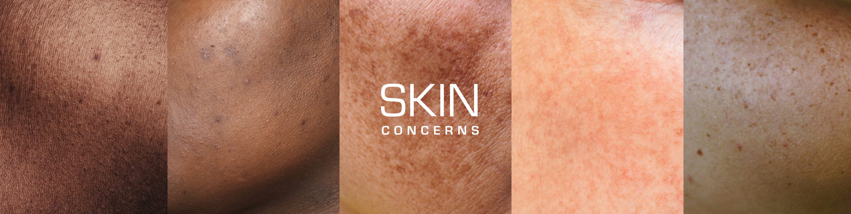 Skin Concerns